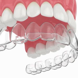 Ortodonti Eğitimi