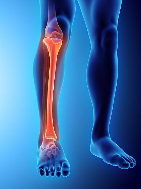 Lower Leg Pain - Hippocrates Online